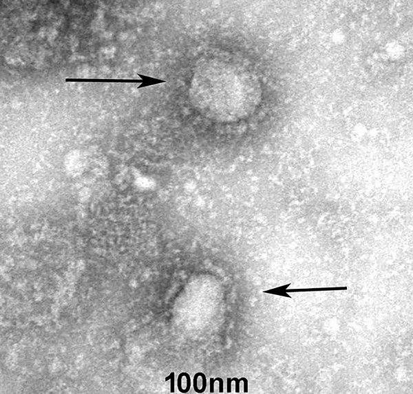 新型コロナウィルス