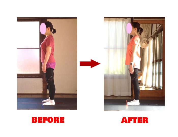 Mさんビフォーアフター２