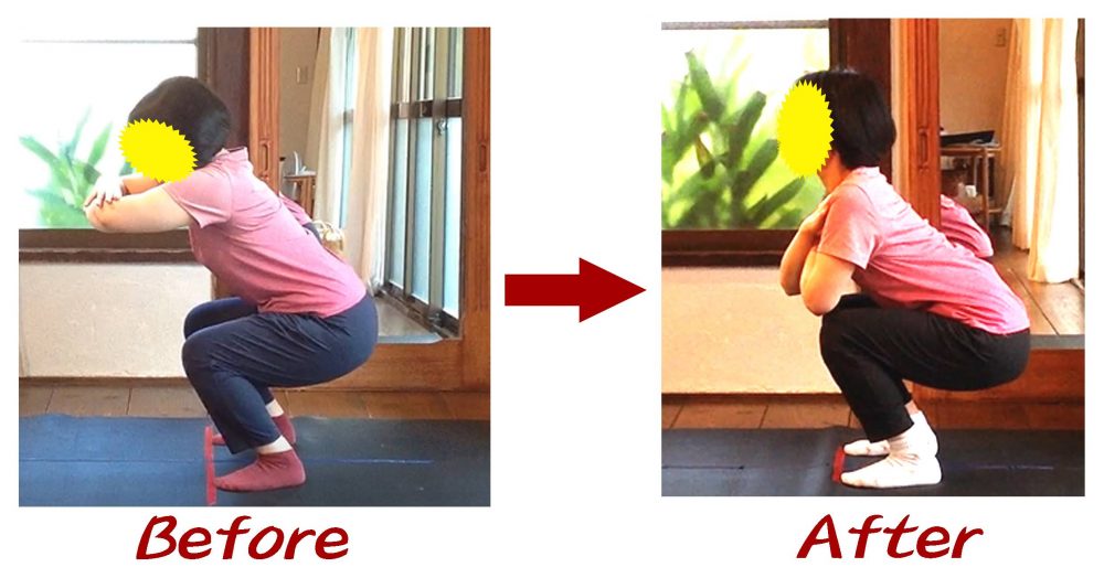 Kさんビフォーアフター5