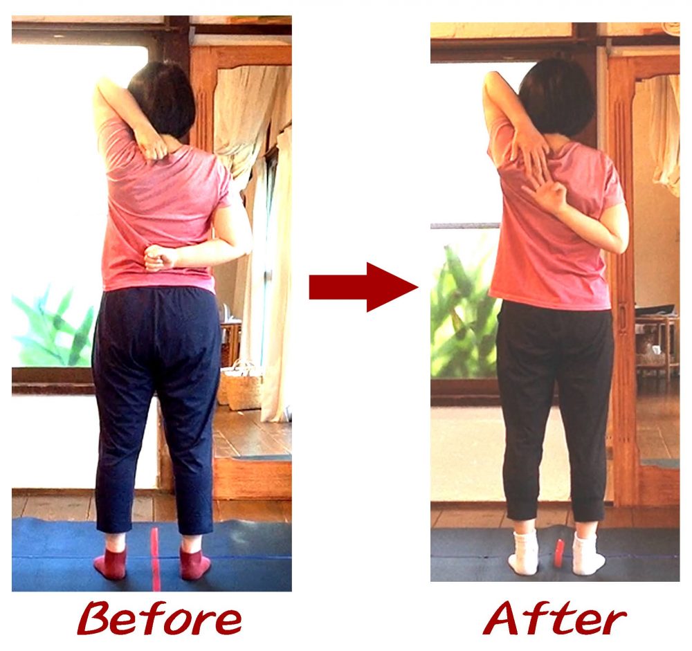 Kさんビフォーアフター7