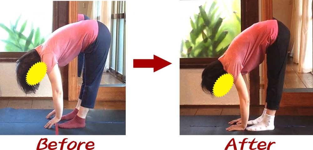 Kさんビフォーアフター2