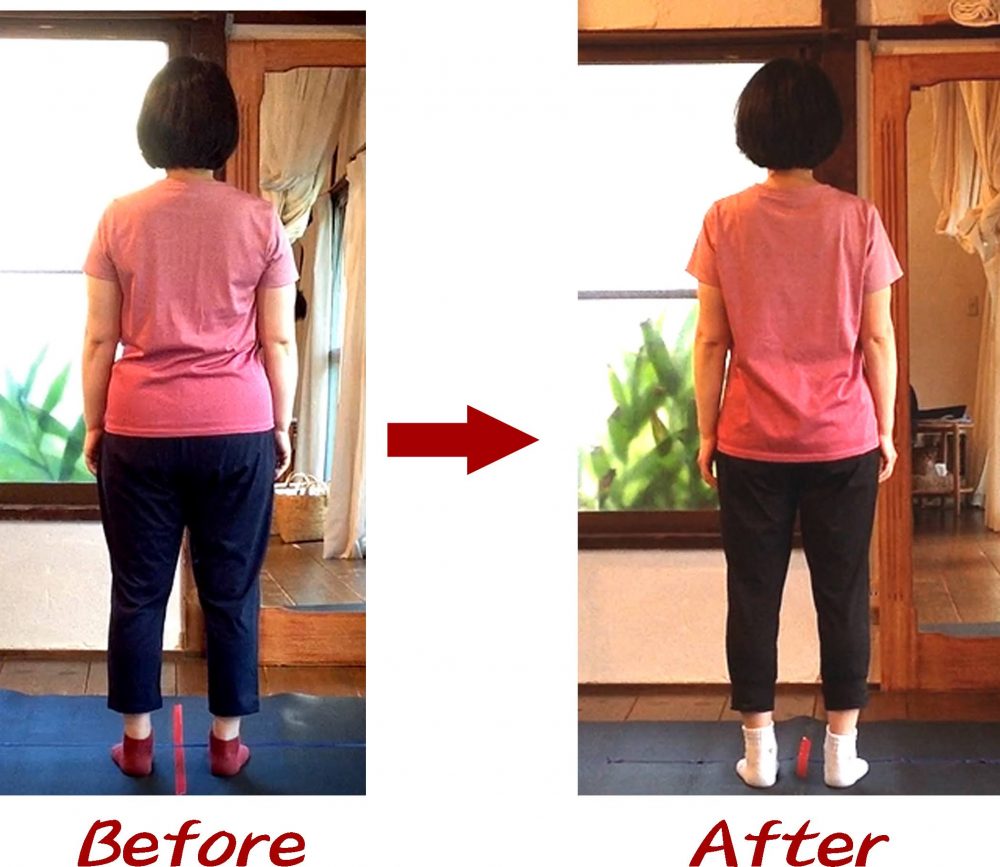 Kさんビフォーアフター1
