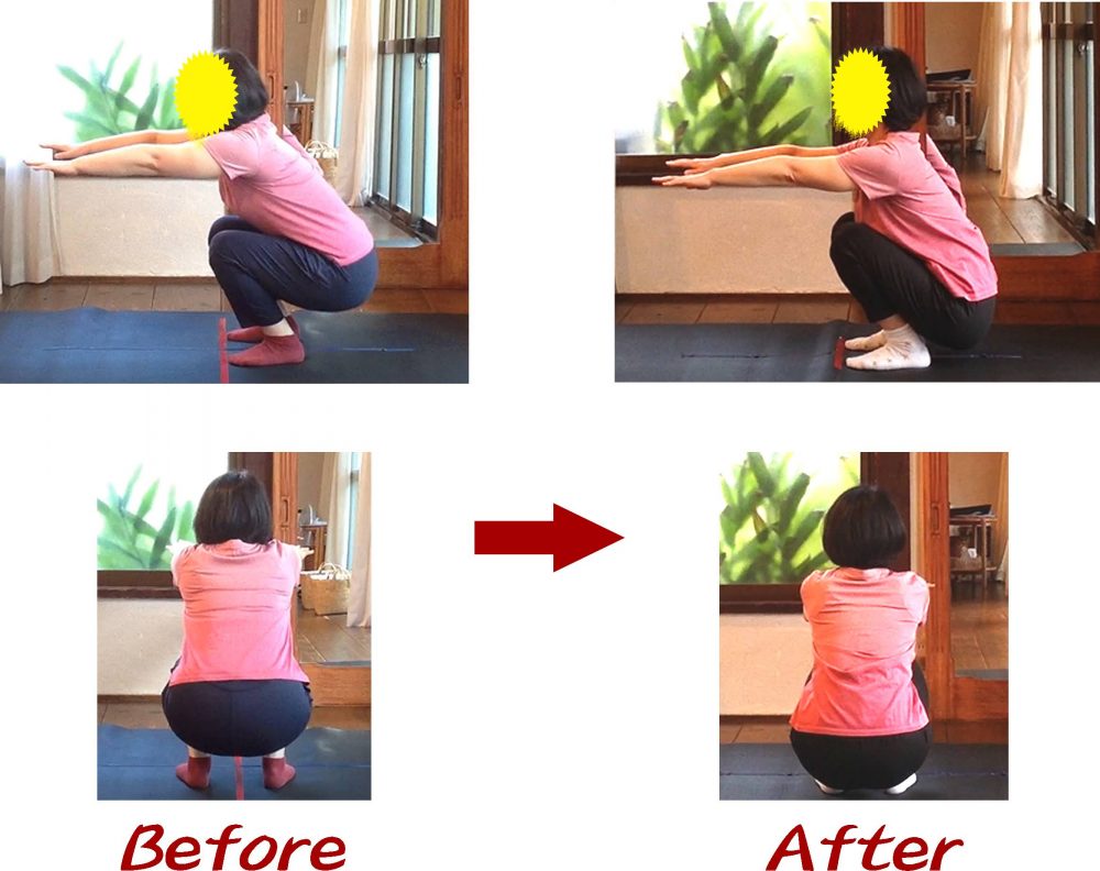 Kさんビフォーアフター4