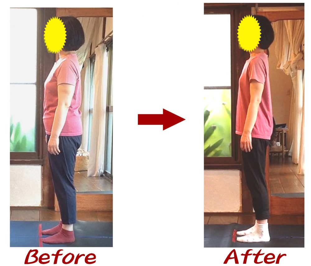 Kさんビフォーアフター6